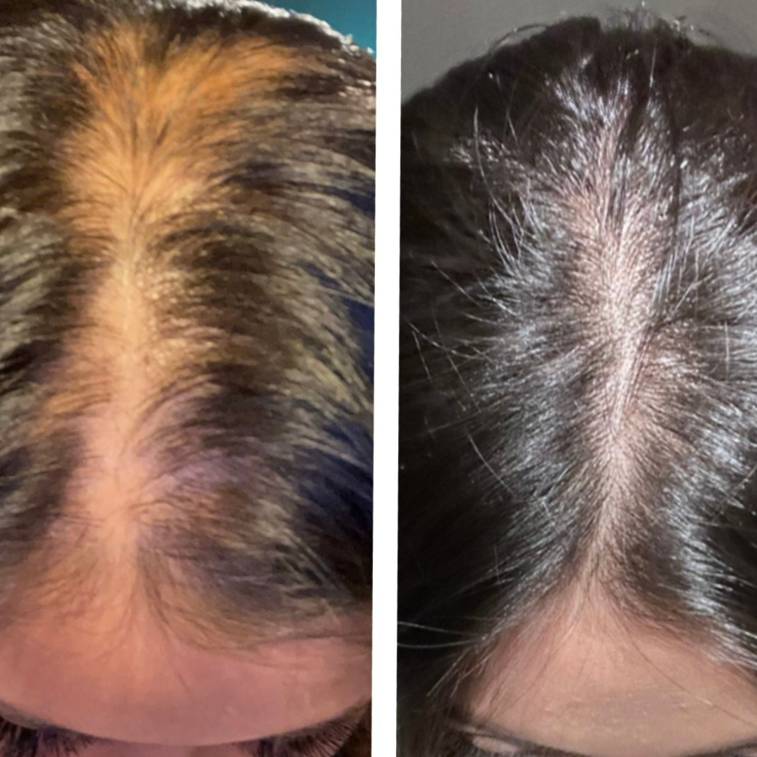 Hair Oil