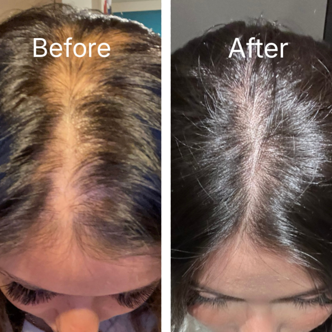 Hair Oil