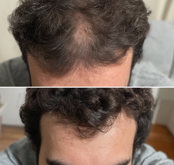 Before transformation