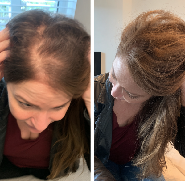 Before transformation