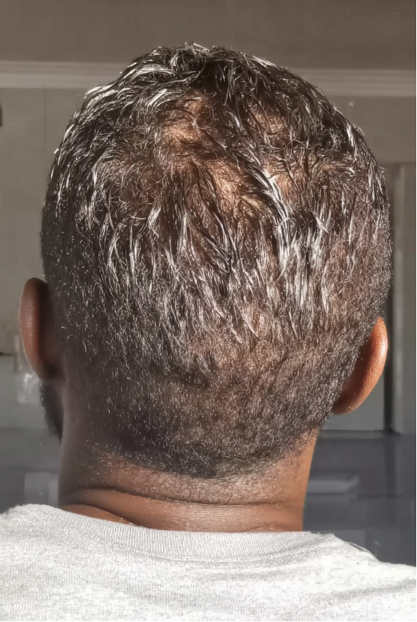 After transformation