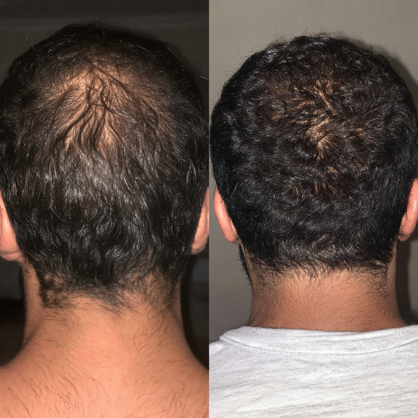 Before transformation