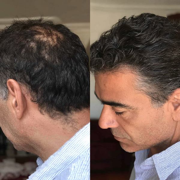 Before transformation