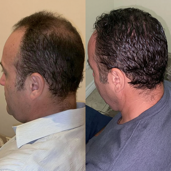 Before transformation
